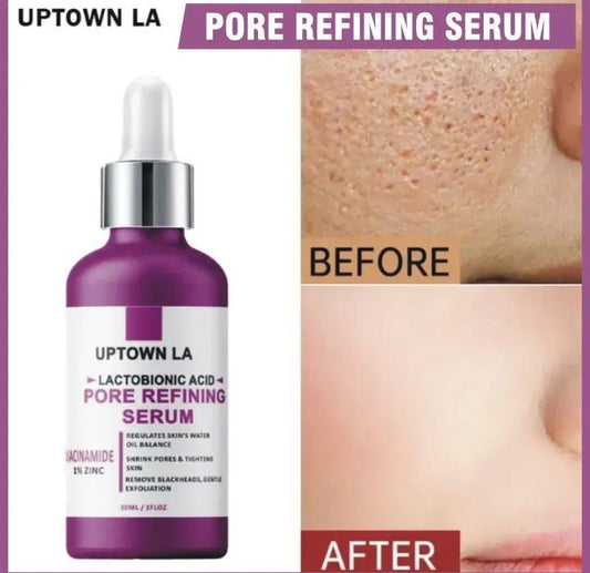 Uptown LA Blemish Removal Face Serum | Acne & Dark Spot Treatment