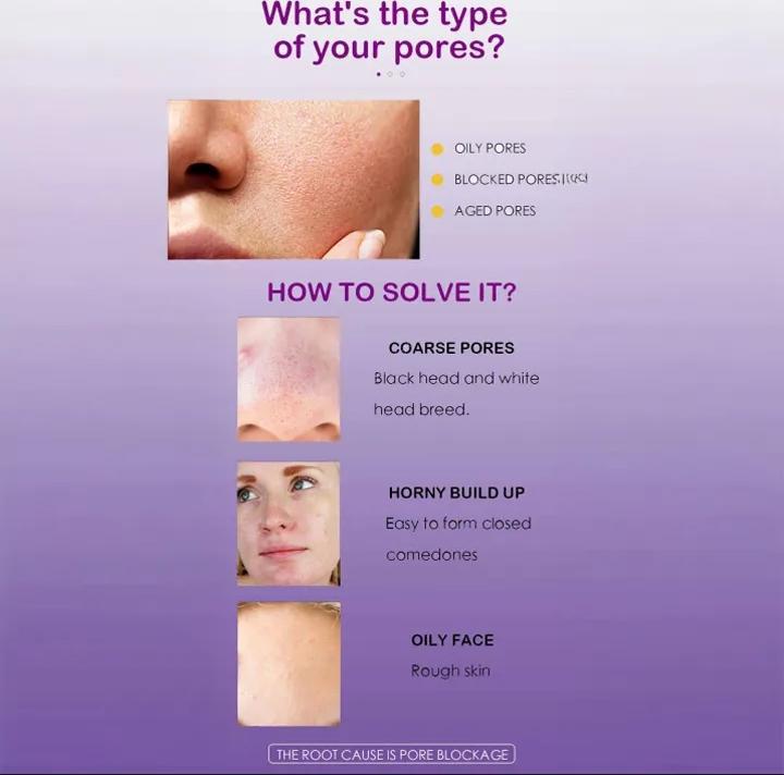 Uptown LA Blemish Removal Face Serum | Acne & Dark Spot Treatment